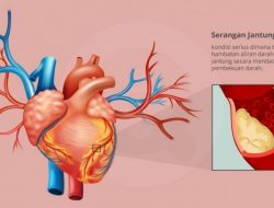 Usia Pasien Serangan Jantung di Indonesia Rata-rata 57 Tahun, Amerika atau Eropa antara 60-65 tahun