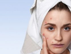 7 Tips Mengatasi Kulit Wajah Sensitif dengan Bahan Alami