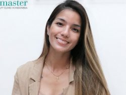 9 Potret Terbaru Sheila Marcia Tanpa Tato di Wajah, Makin Cantik!
