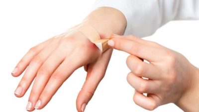 Jangan Sampai Iritasi, Orang dengan Kulit Sensitif Perlu Plester Luka dengan Bahan Khusus